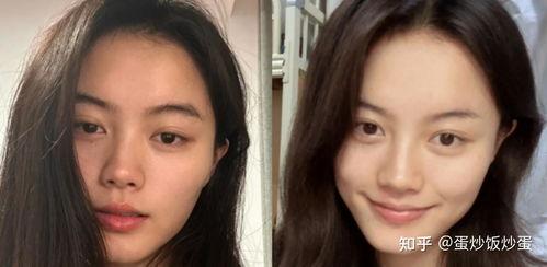 脸发黄脸的照片,照片中的健康信号  第3张